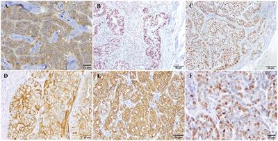Analysis of cell-free DNA concentration, fragmentation patterns and TP53 gene expression in mammary tumor-bearing dogs: A pilot study